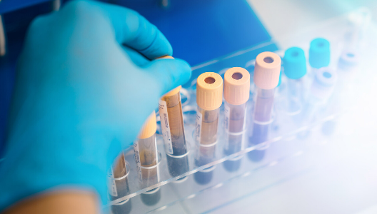 Blood Test Predict COPD