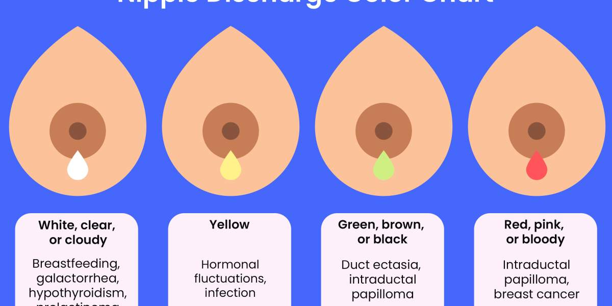 GettyImages-1035410472-nipple-discharge-chart.jpg