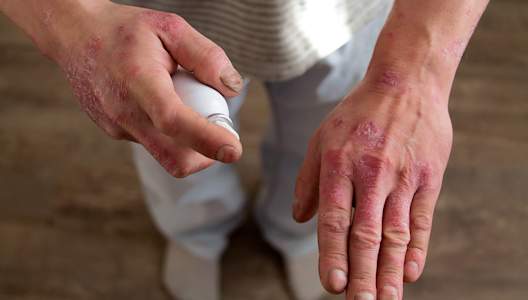 GettyImages-1137585930-3000x2000.jpg