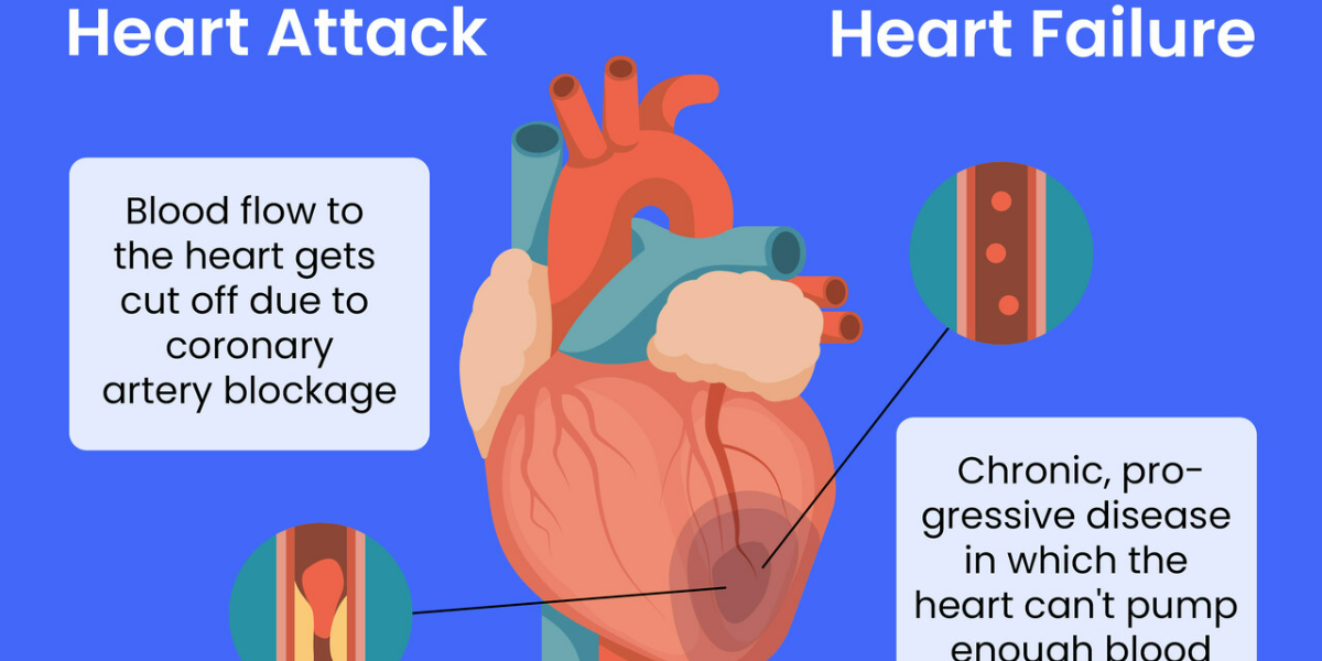 The Nuances of Heart Attack and Heart Failure