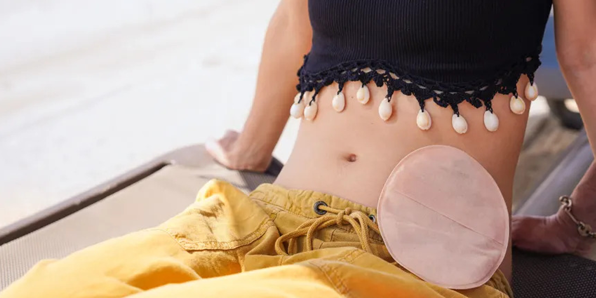 Yes, You Can Swim With a Colostomy—Here’s How