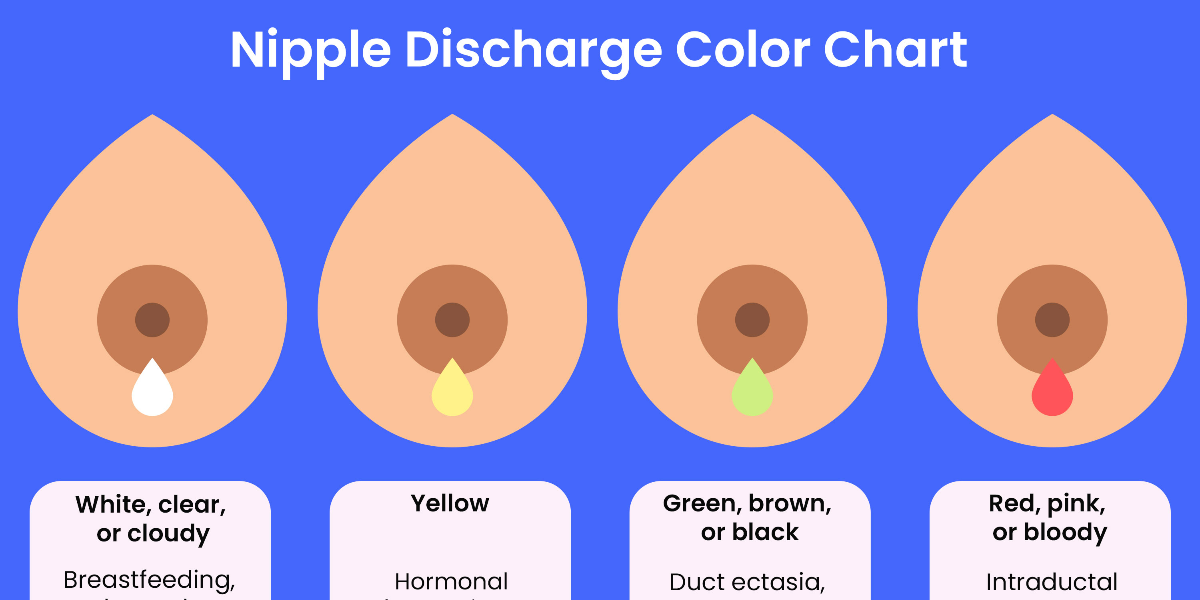 Nipple Discharge