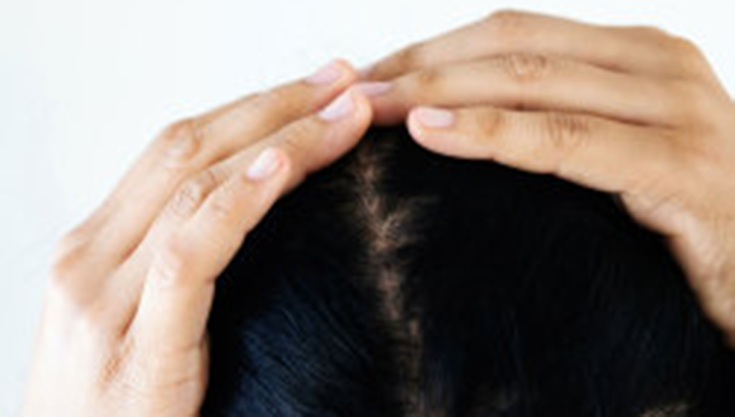 Women's Health - These Hair-Loss Facts May Surprise You (#4)