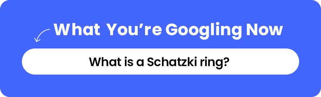 What is a Schatzki ring? 