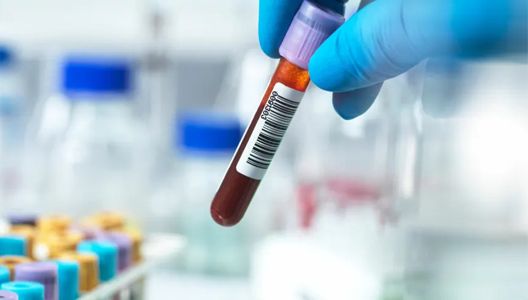 Is It Possible Your Cholesterol Is Too Low?