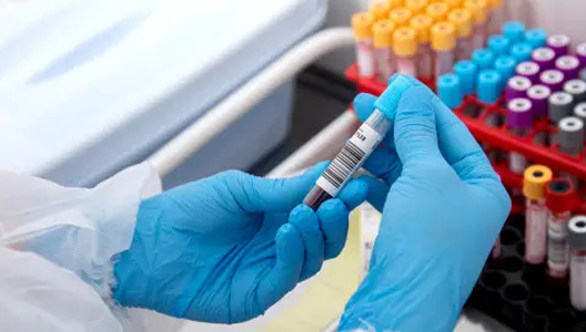 Can a Blood Test Detect a Heart Attack?