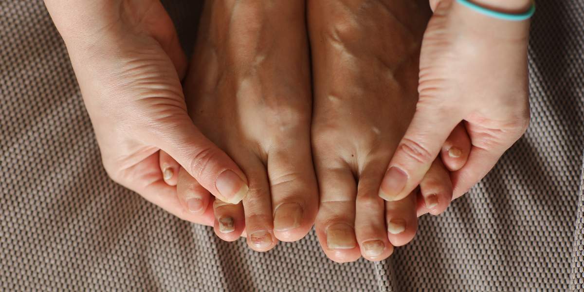 chemotherapy-nail-damage-GettyImages-1475826805-3000x2000-lg.jpg