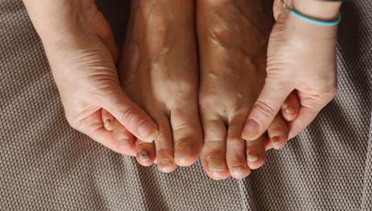chemotherapy-nail-damage-GettyImages-1475826805-3000x2000.jpg