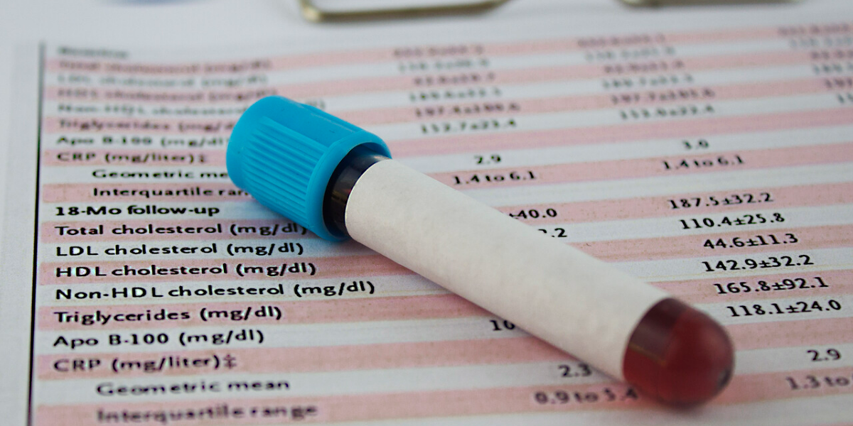 Is It Possible to Have Too Much ‘Good’ Cholesterol