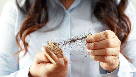 The Link Between RA and Hair Loss