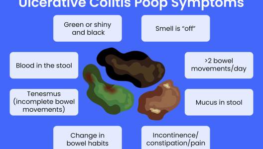 large-GettyImages-1386111248-uc-poop-symptoms.jpg