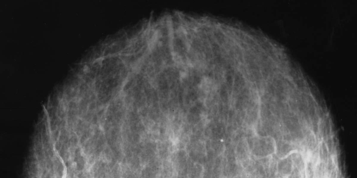 nci-vol-2698-300-3000x2000.jpg